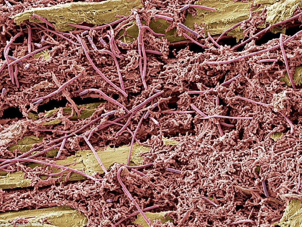 Hinh dang vi khuan bam tren rang nguoi hinh anh