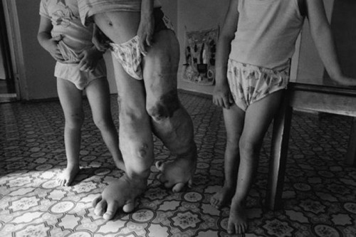 Toan canh tac dong cua tham hoa hat nhan Chernobyl hinh anh