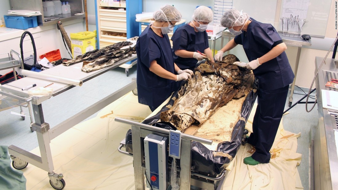 Qua trinh giai phau xac uop o Phap hinh anh