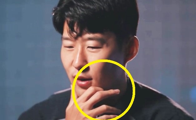 Hinh anh gay sot ve chan thuong cua Son Heung-min hinh anh