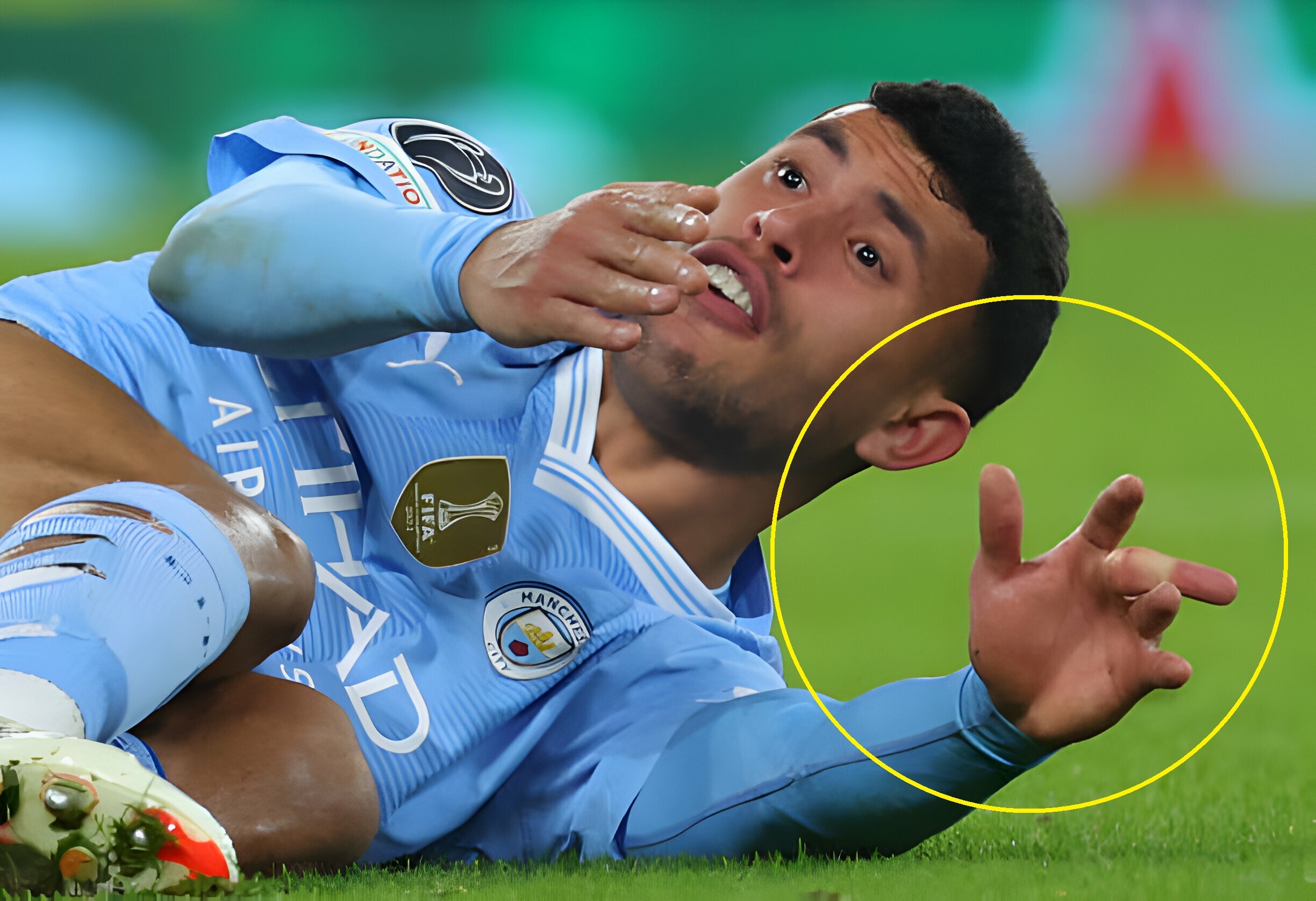 Chan thuong gay soc cua sao Man City hinh anh