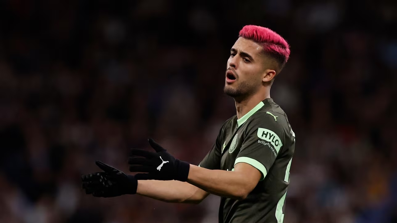 Tuyen Brazil bat cau thu doi mau toc hinh anh