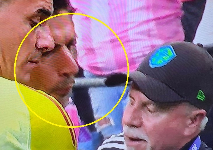 Suarez nho nuoc bot vao mat HLV doi thu sau khi thua chung ket hinh anh