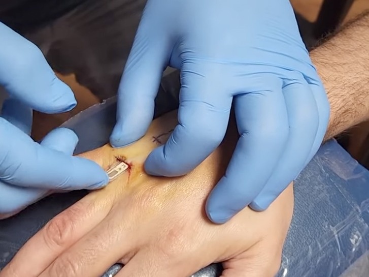 Cay chia khoa vao nguoi anh 3