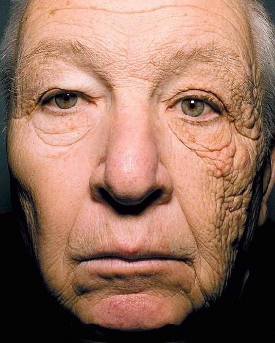 Tai nan hy huu khien nha khoa hoc co nua guong mat 'dong bang' tu 1978 hinh anh