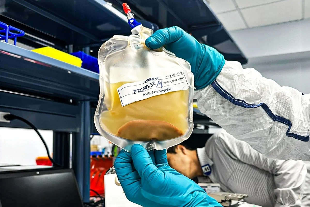 Tui te bao co the phat trien thanh 'la gan thu hai' trong co the nguoi hinh anh