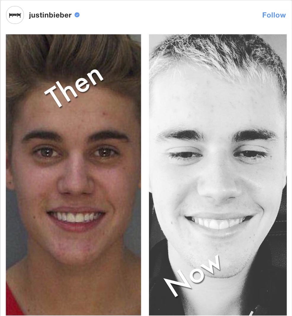 Justin Bieber dang anh ngay xua anh 1