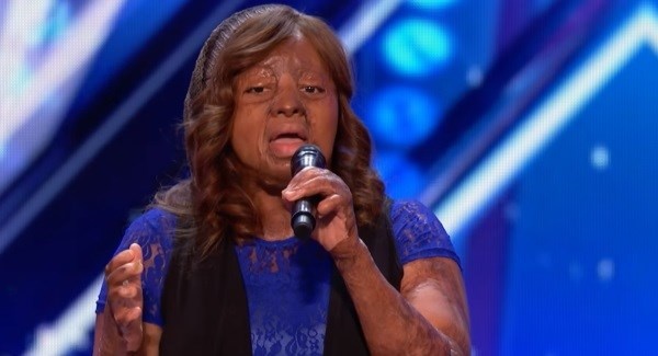 cô gái bị phỏng gây xúc động tại America's Got Talent  ảnh 1 co gai bi phong gay xuc dong tai America's Got Talent anh 1