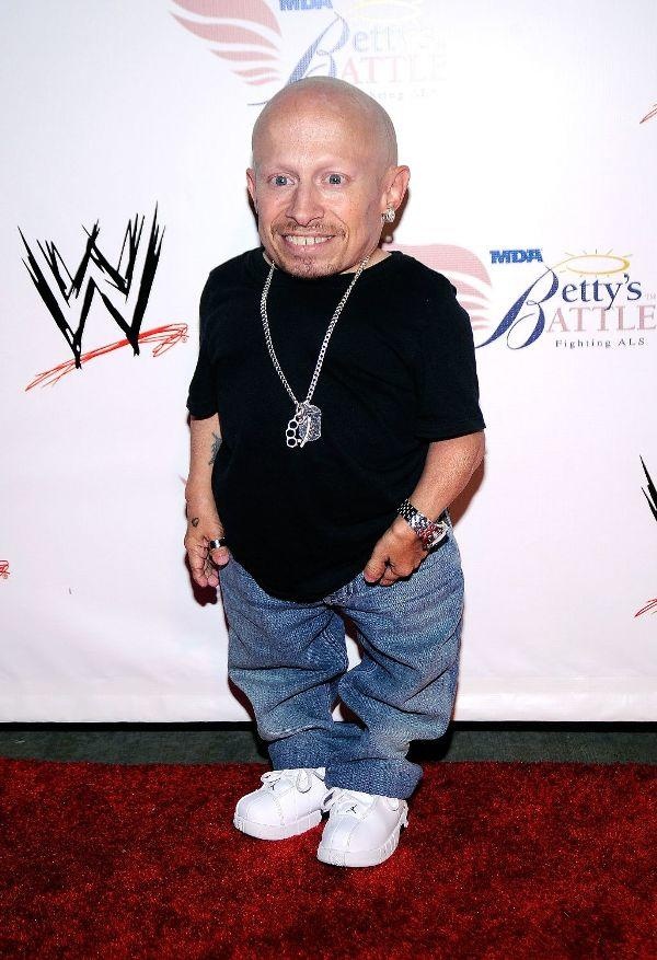 diễn viên tí hon Verne Troyer ảnh 2 dien vien ti hon Verne Troyer anh 2