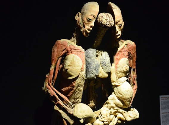 trien lam co the nguoi anh 2