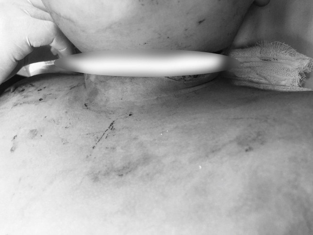 Tinh trang suc khoe cua be trai TP.HCM nghi bi cha tan cong hinh anh