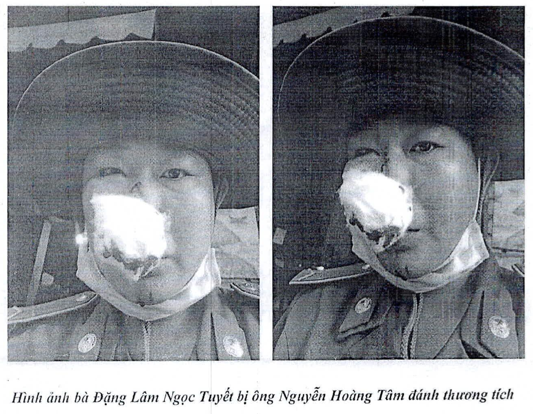 thu phi dau oto anh 1