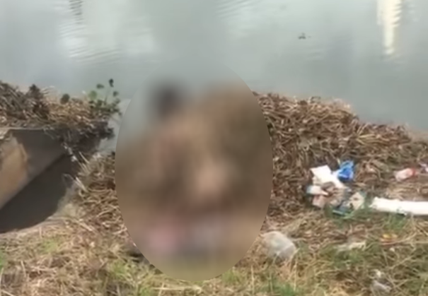 Co gai bi bong nang sau khi tu thieu ben bo ho hinh anh