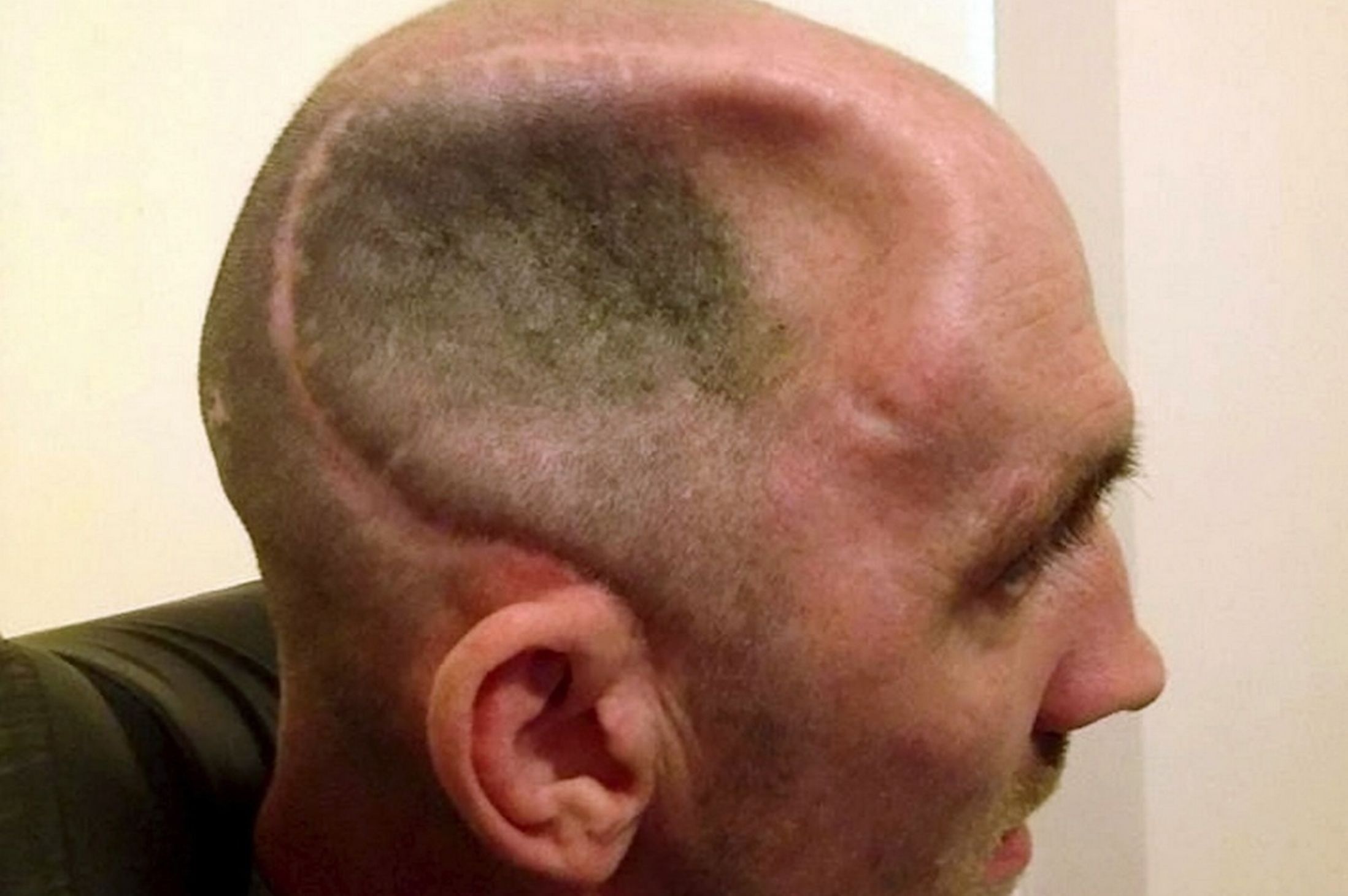 Dau lom, ngoi xe lan ca doi vi mot cu dam hinh anh