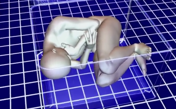 vu an xac chet trong vali anh 2