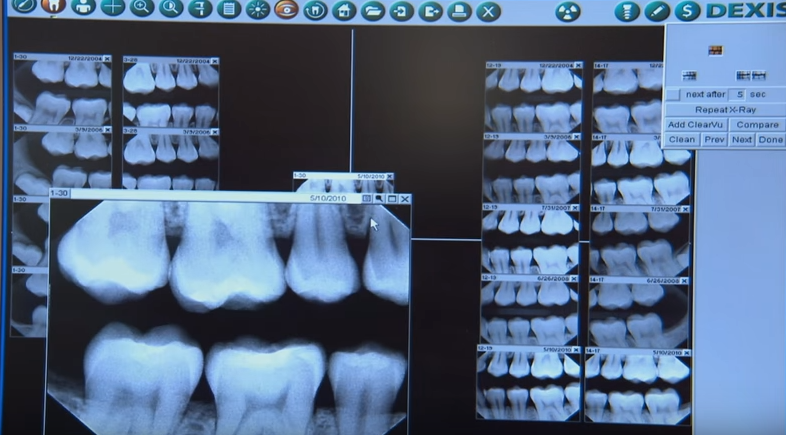 Vu an xac chet trong vali anh 5