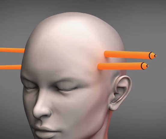 La thu tuyet menh anh 7