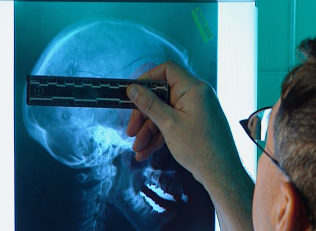 La thu tuyet menh anh 4