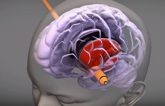 La thu tuyet menh anh 5