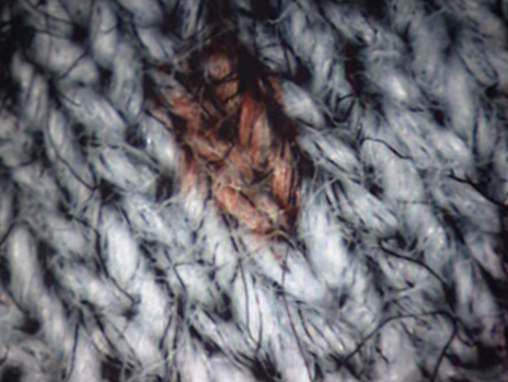 La thu tuyet menh anh 9