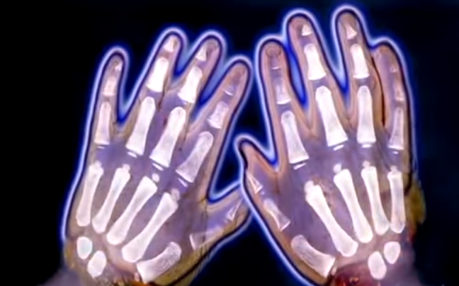 Pha an tu doi ban tay dut lia anh 2