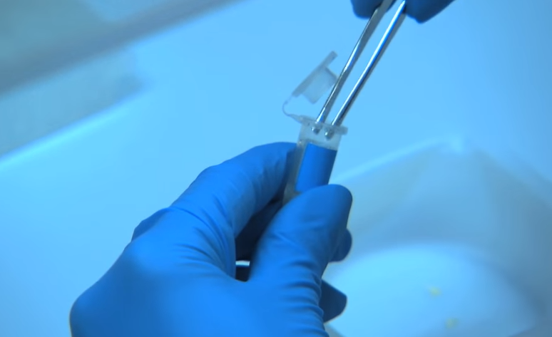 Vet can tren tu thi vach mat ke giet nguoi hinh anh