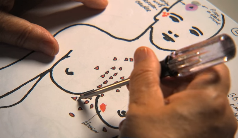 Vach mat ke giet nguoi anh 10