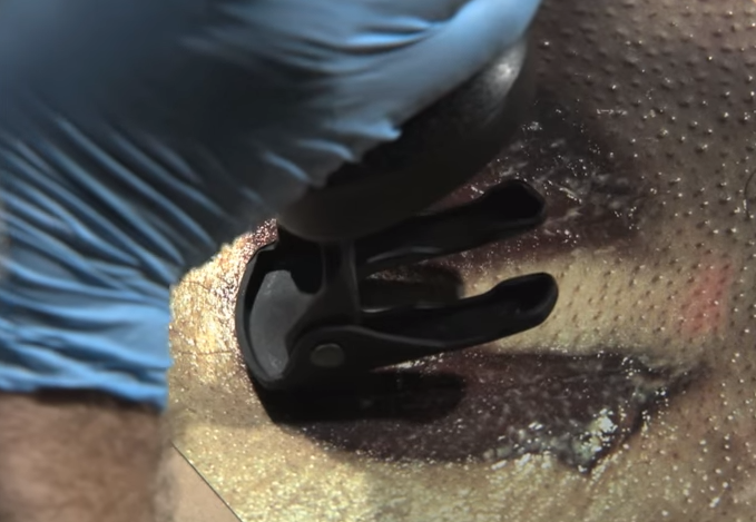 Vach mat ke giet nguoi anh 9