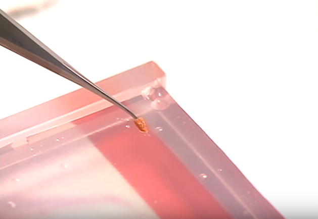 Manh moi pha an anh 6