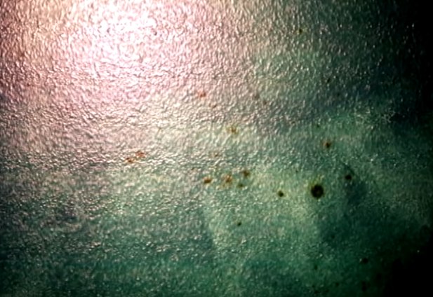 chan nguoi trong thung rac anh 6