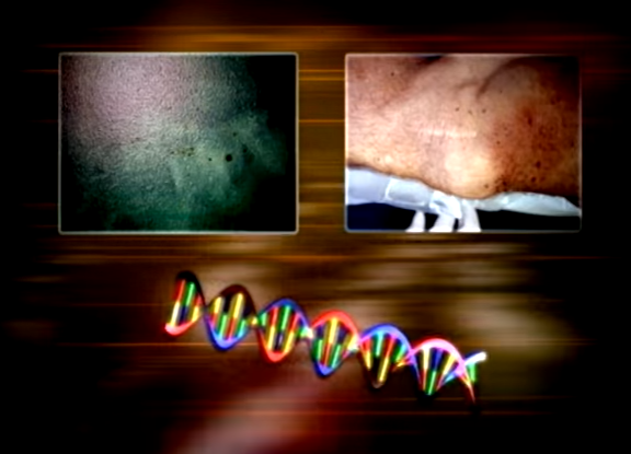 chan nguoi trong thung rac anh 1