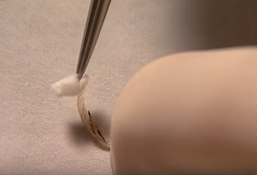 Vach mat ke giet nguoi anh 1