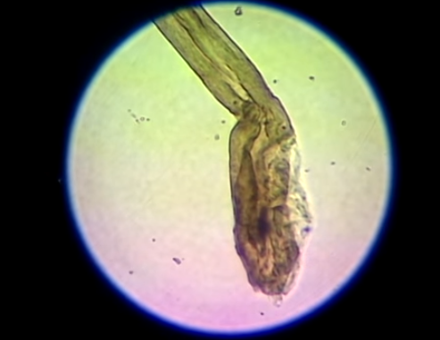 Vach mat ke giet nguoi anh 4