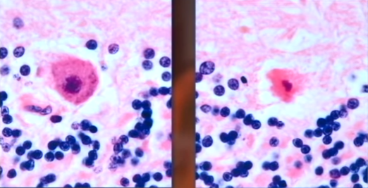 cai chet cua nu pho chu tich anh 12