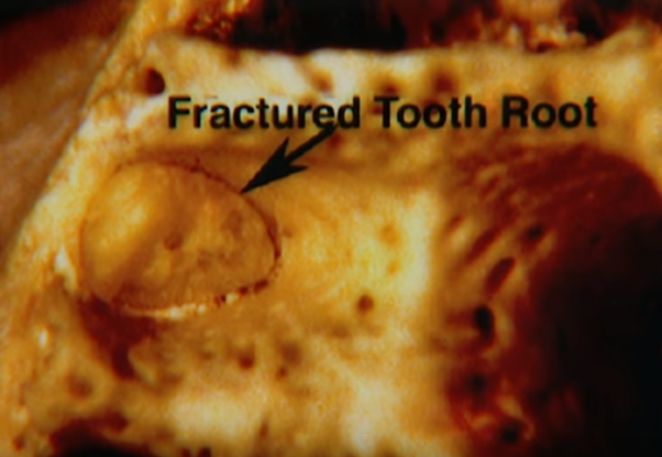 Truy tim ke giet nguoi anh 4