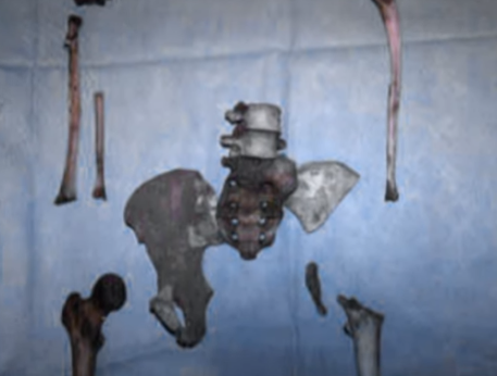 Giet ban gai roi phi tang xac anh 9