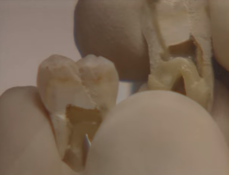 Giet ban gai roi phi tang xac anh 2