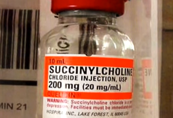 Vach mat ke giet nguoi anh 1