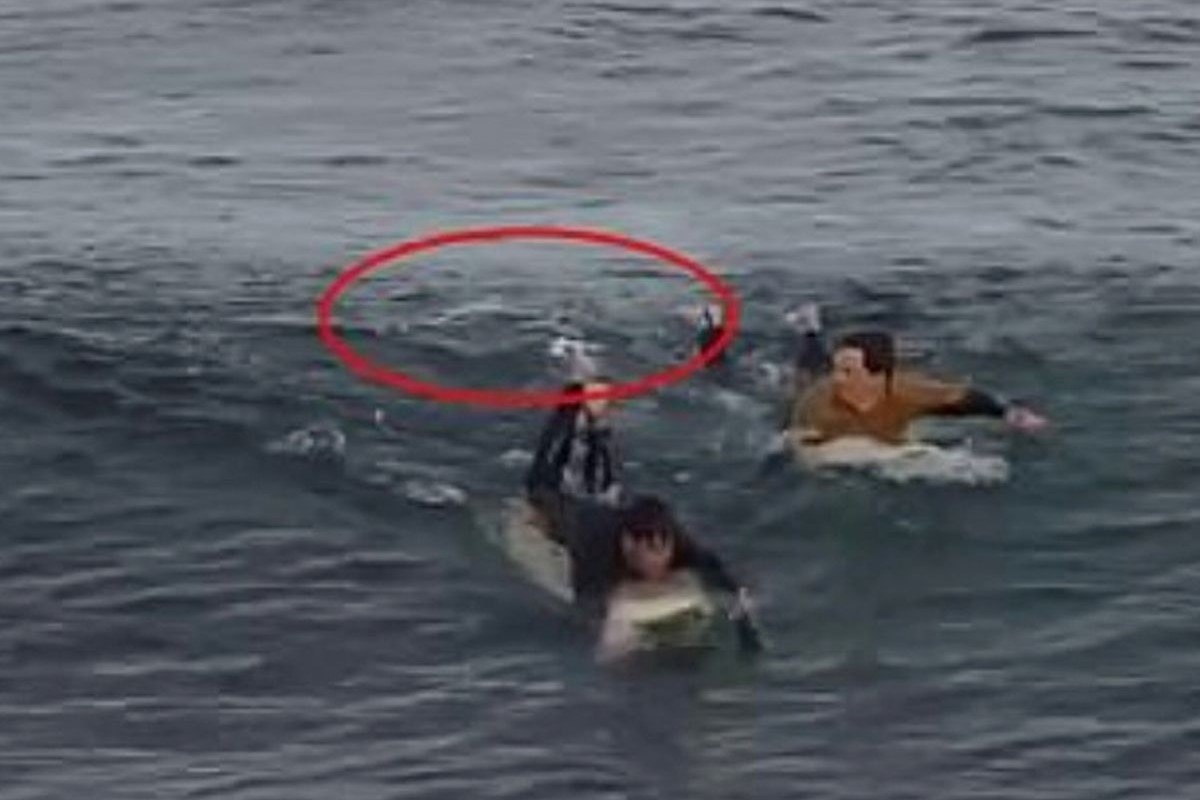 Du khach thoat chet sau khi bi ca map can vao chan hinh anh