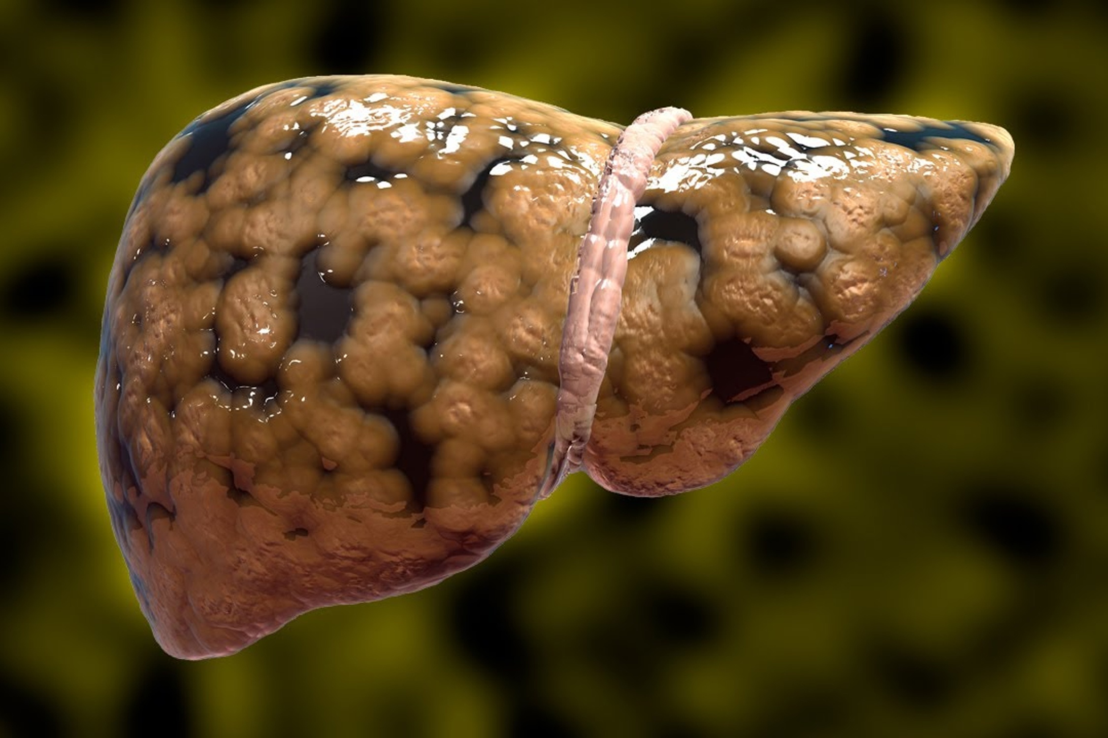 7 dau hieu canh bao gan nhiem mo hinh anh