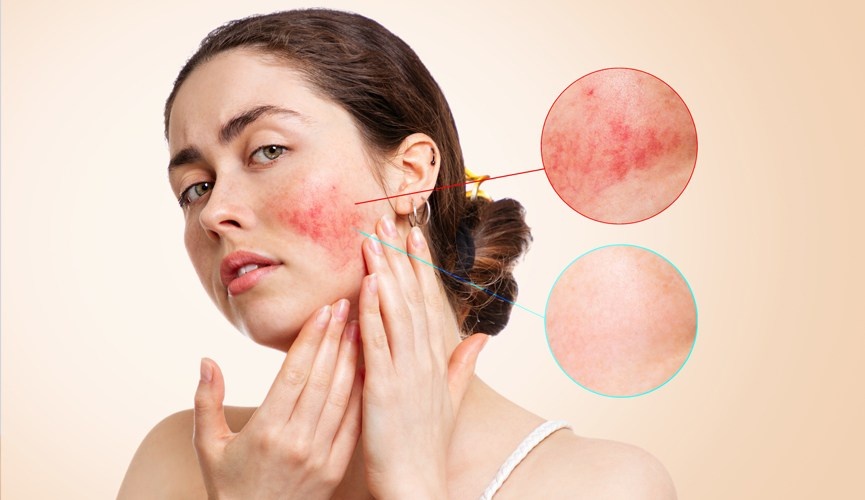 Cac van de ve da tiet lo tinh trang suc khoe hinh anh