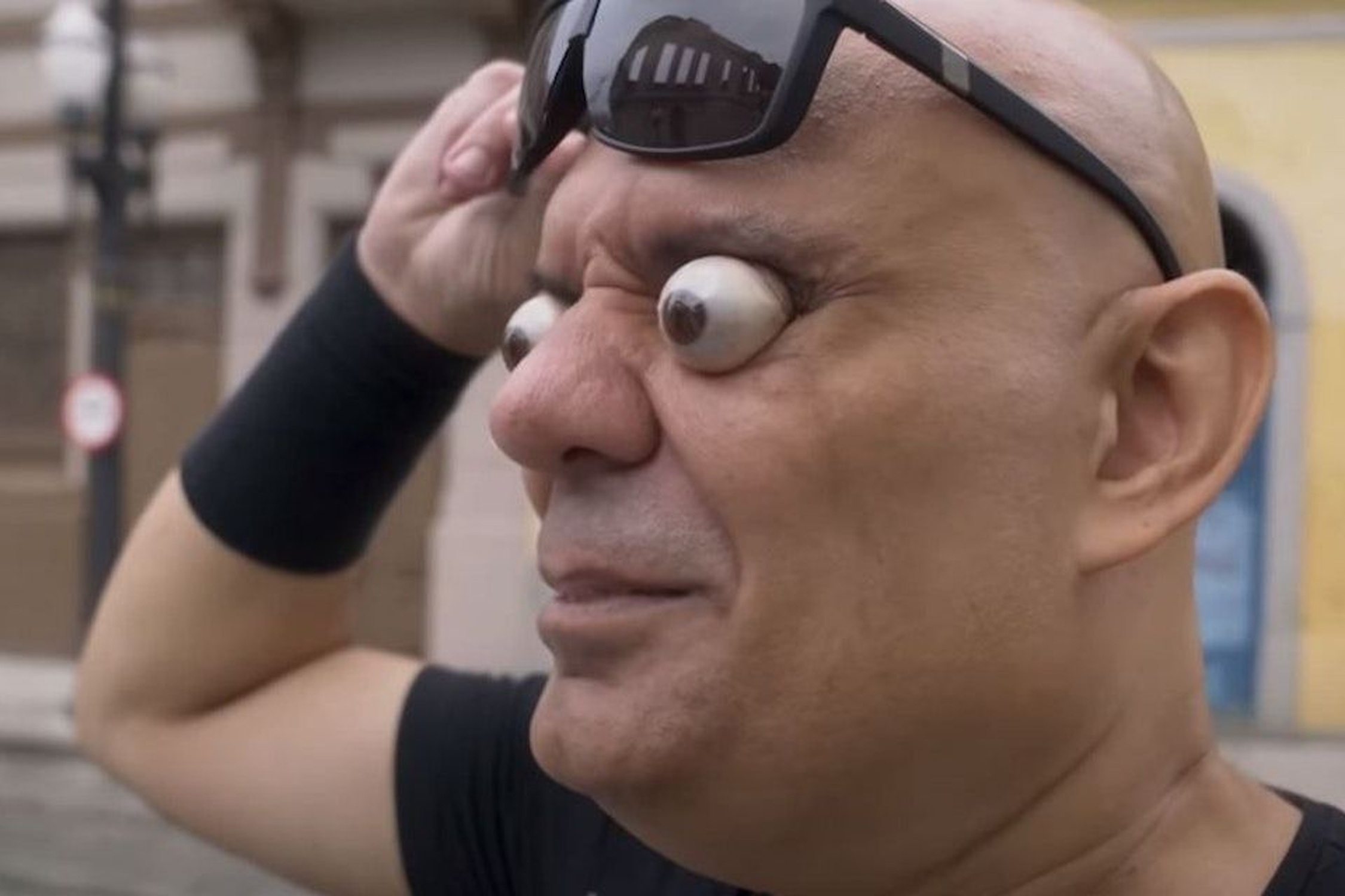 'Di nhan' co the loi nhan cau ra khoi hoc mat hinh anh