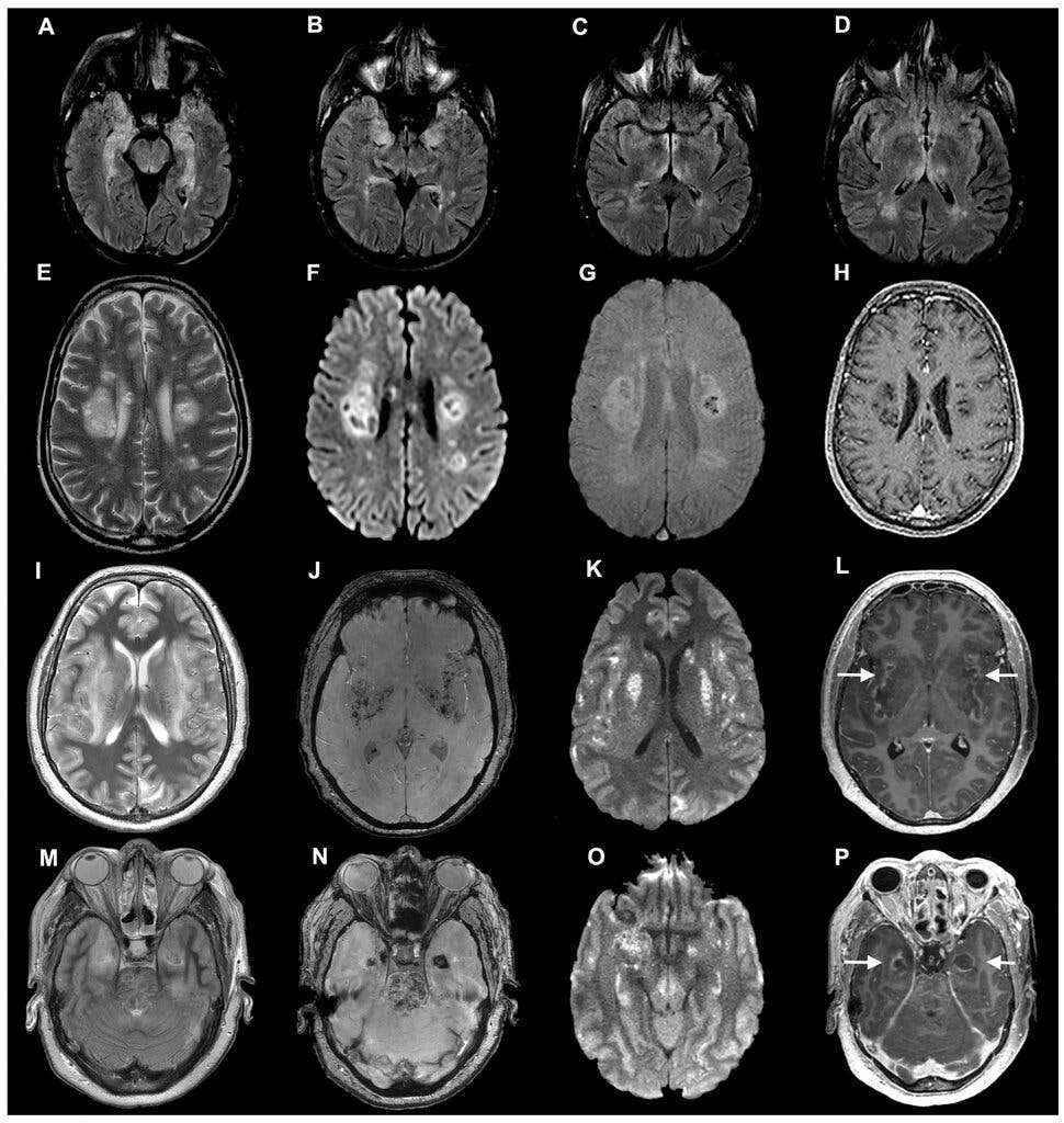 tai nhiem Covid-19 anh 3