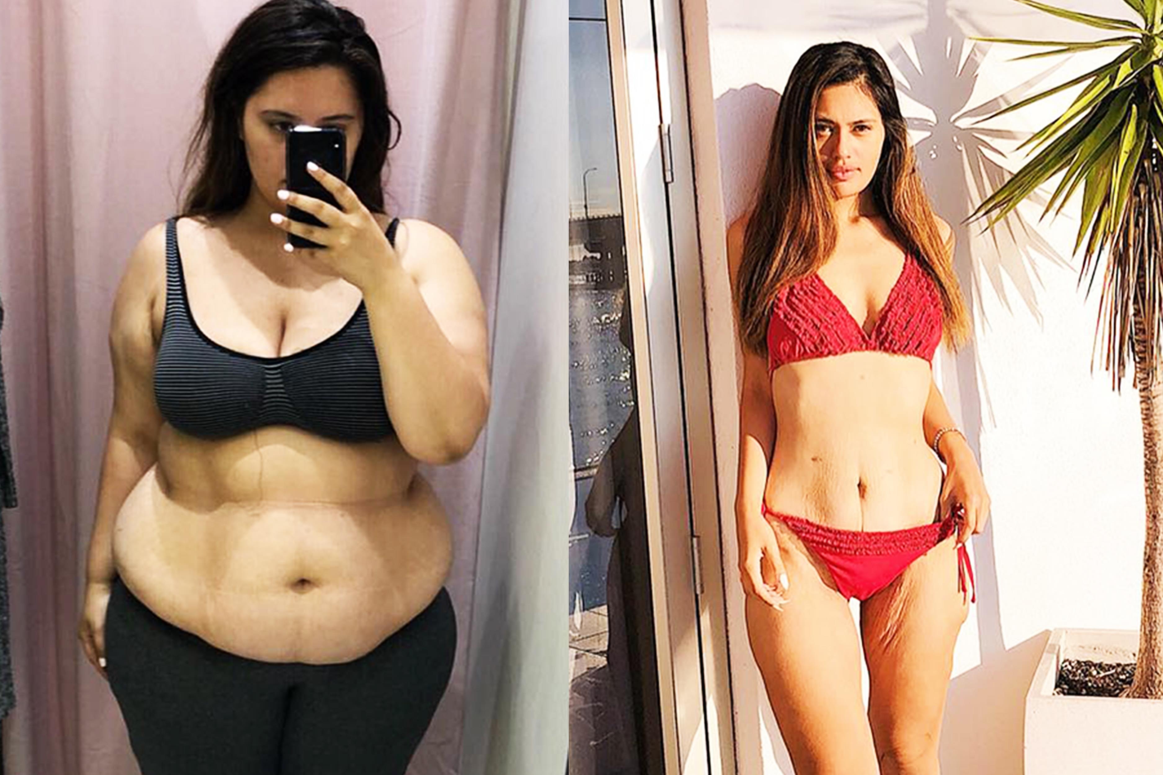 Giam can bang viec cat bo mot phan da day co hieu qua? hinh anh