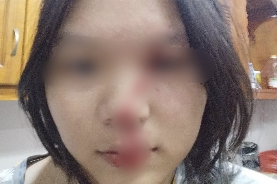 4 me con cau cuu cong an vi bi bao hanh hinh anh