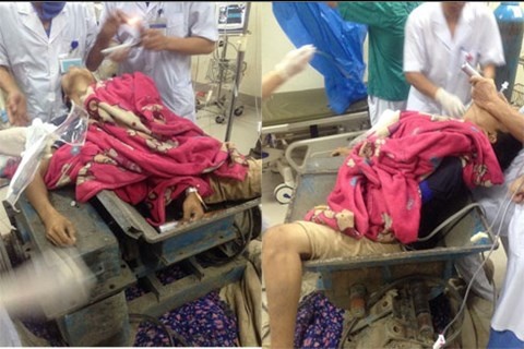 Nam thanh nien bi nghien nat chan va mac ket trong may gach hinh anh