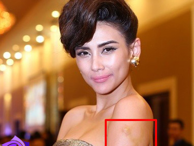 Nhung 'vet tich' kho hieu tren co the my nhan hinh anh