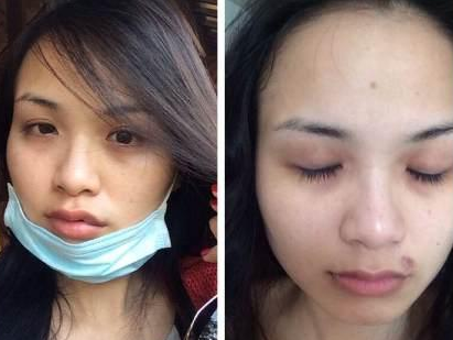 Diem Huong cong khai vet tich bi chong cu hanh hung hinh anh