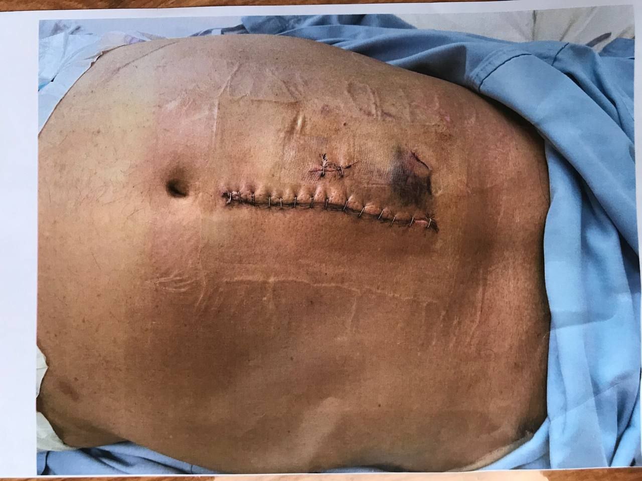 be boi tinh duc Campuchia anh 3