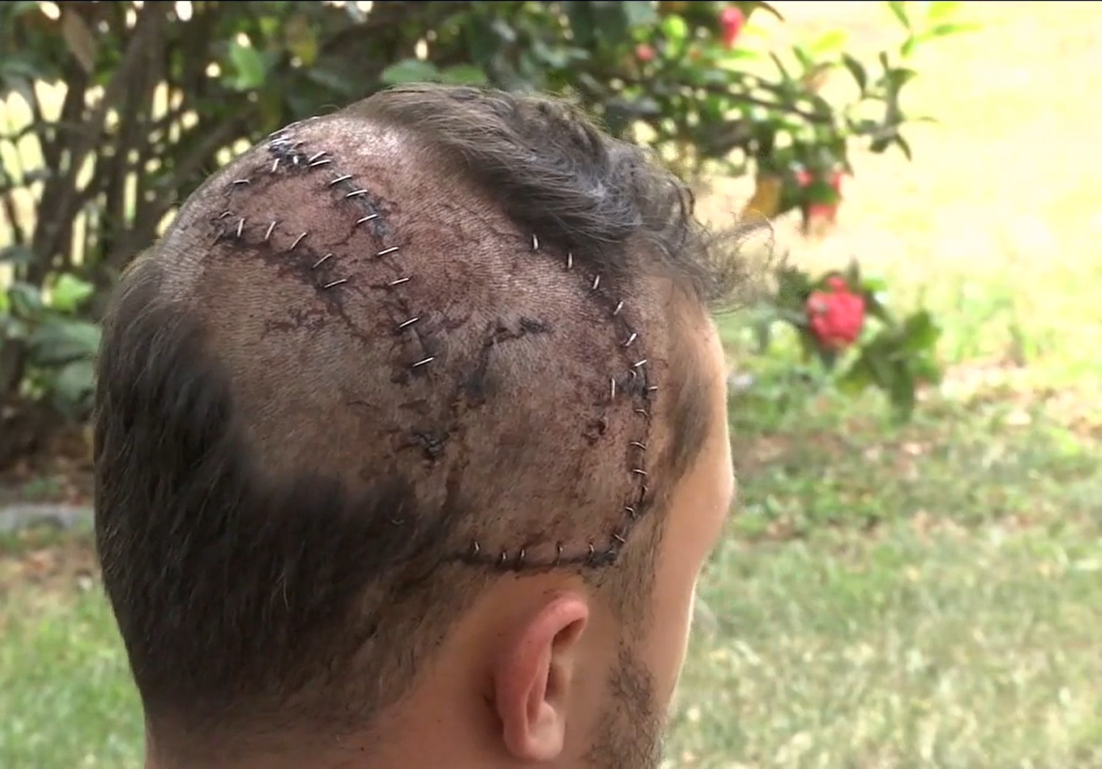 Di san tim rang ca map, nguoi dan ong bi ca sau can nut so hinh anh